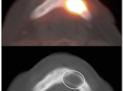 Case 4 (Image 1)