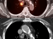 Case 1 (Image 4)