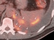 Case 3 (Image 4)