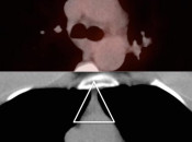 Case 1 (Image 4)
