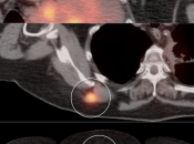 Case 5 (Image 4)