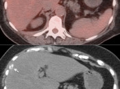 Case 2 (Image 4)