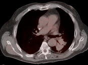 Case 10 (Image 4)