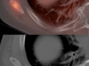 Case 5 (Image 4)