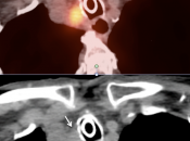 Case 4 (Image 4)