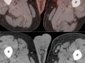 Case 2 (Image 4)