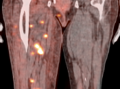 Case 3 (Image 4)