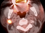 Case 4 (Image 4)
