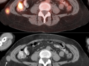 Case 5 (Image 4)