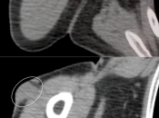Case 7 (Image 4)
