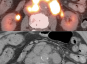 Case 5 (Image 4)
