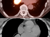 Case 5 (Image 4)