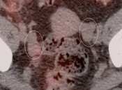 Case 1 (Image 4)