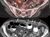 Case 5 (Image 4)