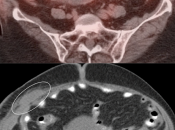 Case 6 (Image 4)