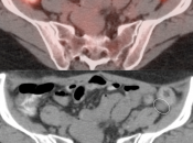 Case 7 (Image 4)