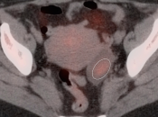 Case 8 (Image 4)