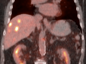 Case 2 (Image 4)