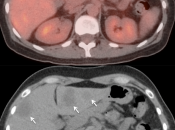 Case 4 (Image 4)