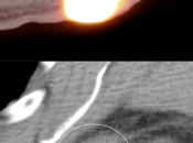 Case 6 (Image 4)