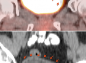 Case 1 (Images 4)