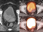 Case 2 (Image 4)