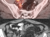 Case 4 (Image 4)