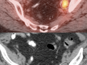 Case 5 (Image 4)