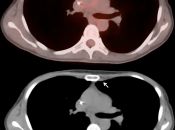 Case 2 (Image 4)