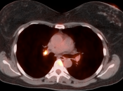 Case 4 (Image 4)