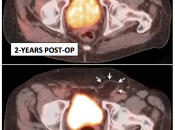 Case 5 (Image 1)
