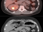 Case 2 (Image 5)