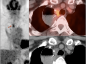 Case 6 (Image 5)
