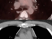 Case 1 (Image 5)