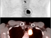Case 2 (Image 5)