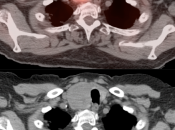 Case 5 (Image 5)