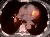 Case 2 (Image 5)