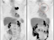 Case 9 (Image 5)
