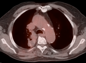 Case 10 (Image 5)