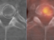 Case 3 (Image 5)