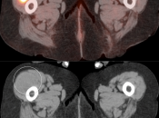Case 5 (Image 5)