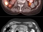 Case 5 (Image 5)