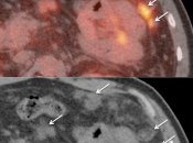 Case 3 (Image 5)