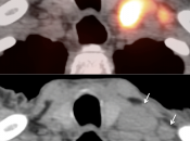 Case 5 (Image 5)