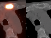 Case 12 (Image 5)