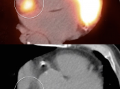 Case 3 (Image 5)
