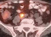Case 4 (Image 5)