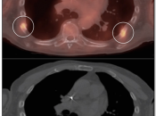 Case 2 (Image 5)