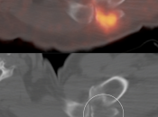Case 3 (Image 6)