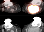 Case 5 (Image 6)